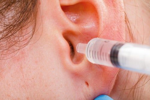 cómo limpiar los oídos en casa de forma natural